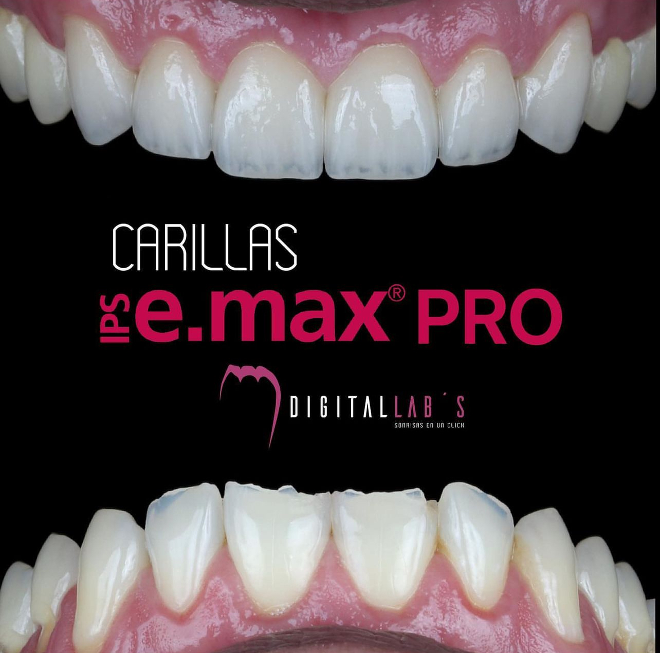 E.MAX PRO E.MAX PRO